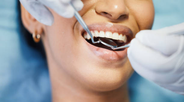 Best Emergency Treatment for Toothache in Centreville, VA